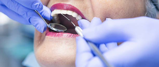 Best Emergency Dental Care for Broken or Chipped Teeth in Schertz, TX