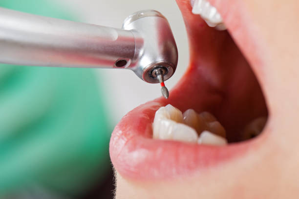 Best Emergency TMJ Treatment in Schertz, TX